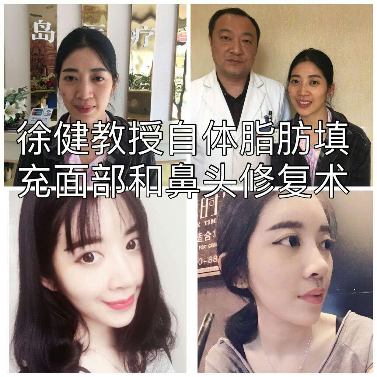 青岛市南区双眼皮开眼角哪家专业|金岛整形