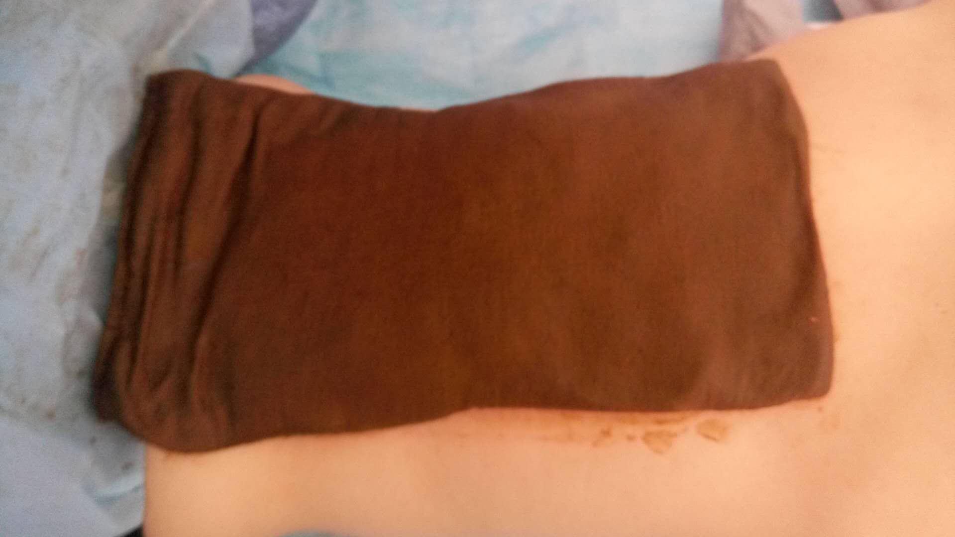 滑膜炎/兰州玉善堂